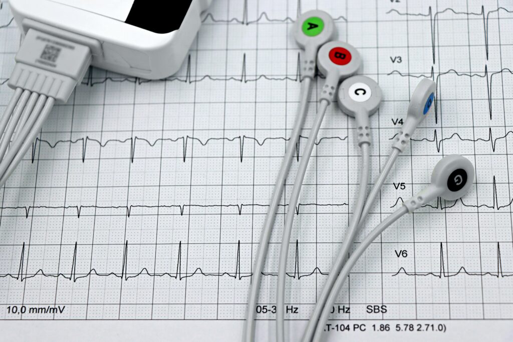 ECG wires and results laid out flat