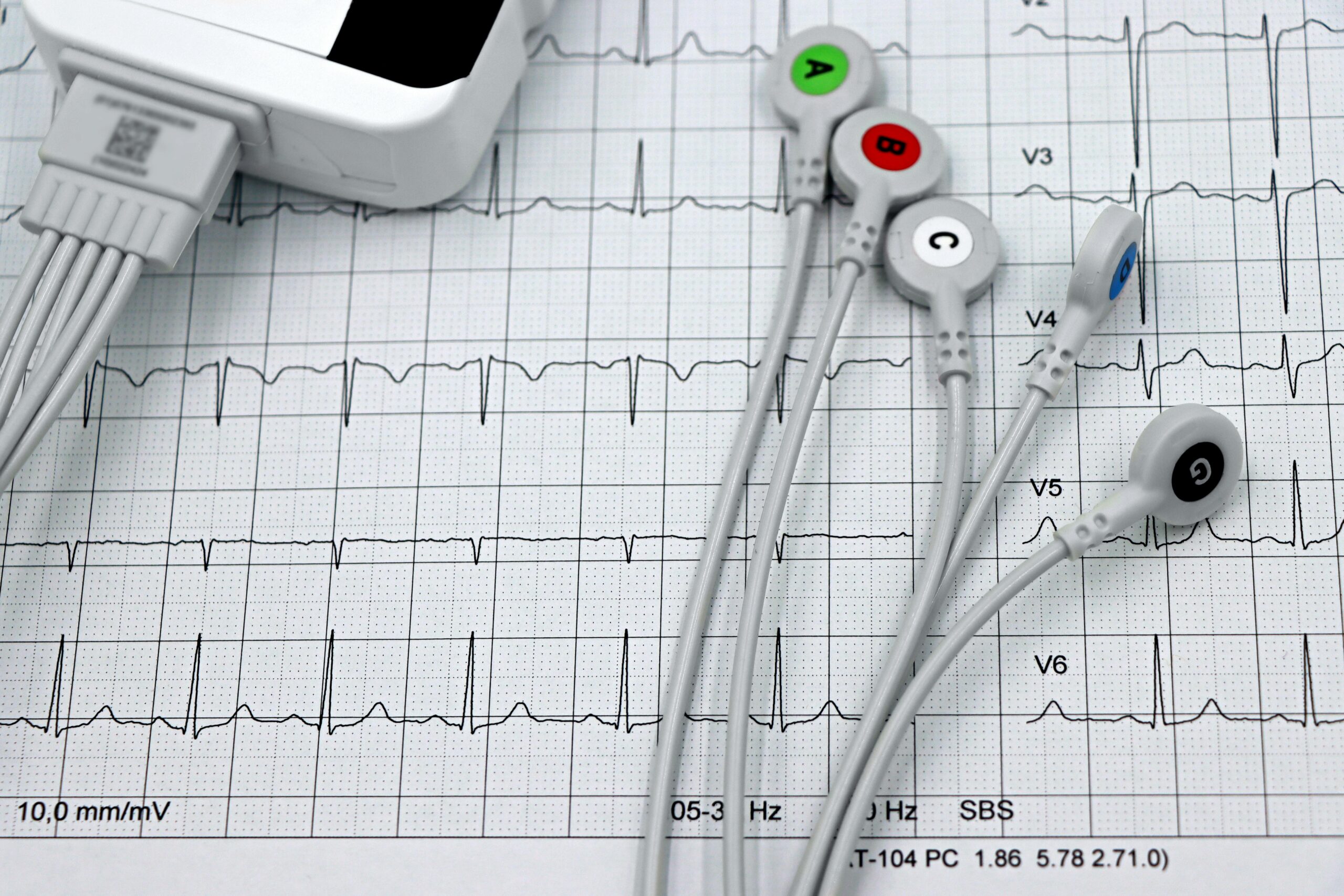 ECG wires and results laid out flat