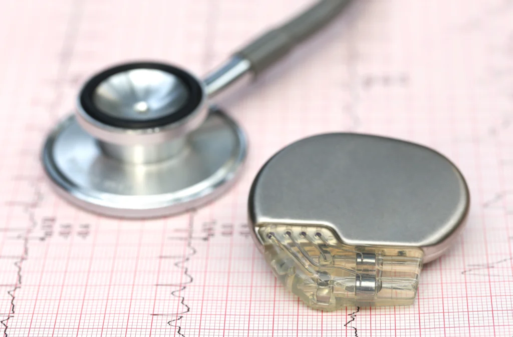 a cardiac or heart pacemaker next to a stethoscope on top of printed heart rhythm data